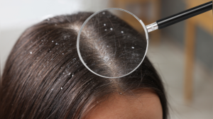 5 subtle hair warning signs commonly overlooked