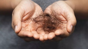Best hair loss treatments for women: What works and what to avoid